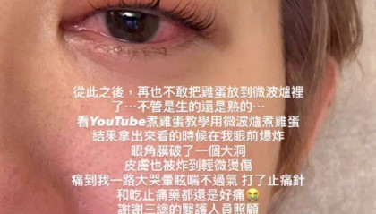 突然爆炸！知名女演员自曝：痛到大哭眩晕