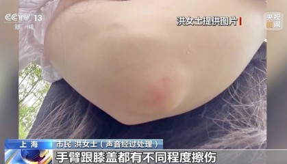 共享单车骑行中遭遇自动落锁，谁来担责？