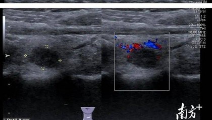 从东北到梅州，跨越3000公里的求医之路……