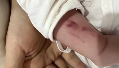 广西一男婴在月子中心被照料20天：身上2处骨折，育婴室监控无法查看