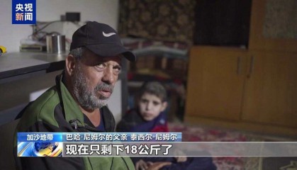 加沙15岁男孩饿到只剩18公斤，民众成批死去只为一块面包