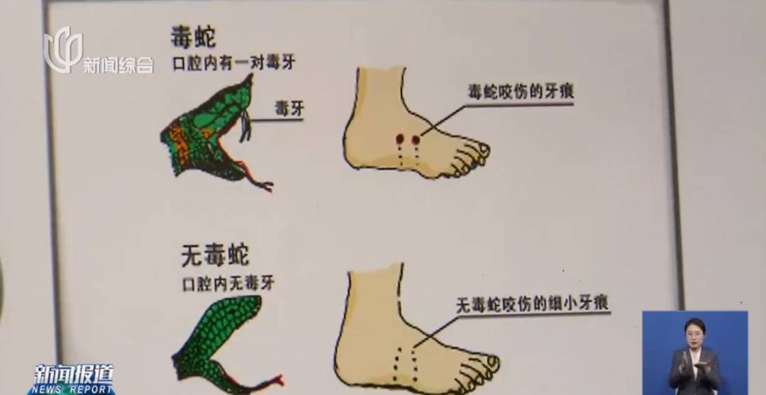 上海七旬老人小区散步被毒蛇咬伤,女儿崩溃:医院怎么选……这份救命指南快收好!