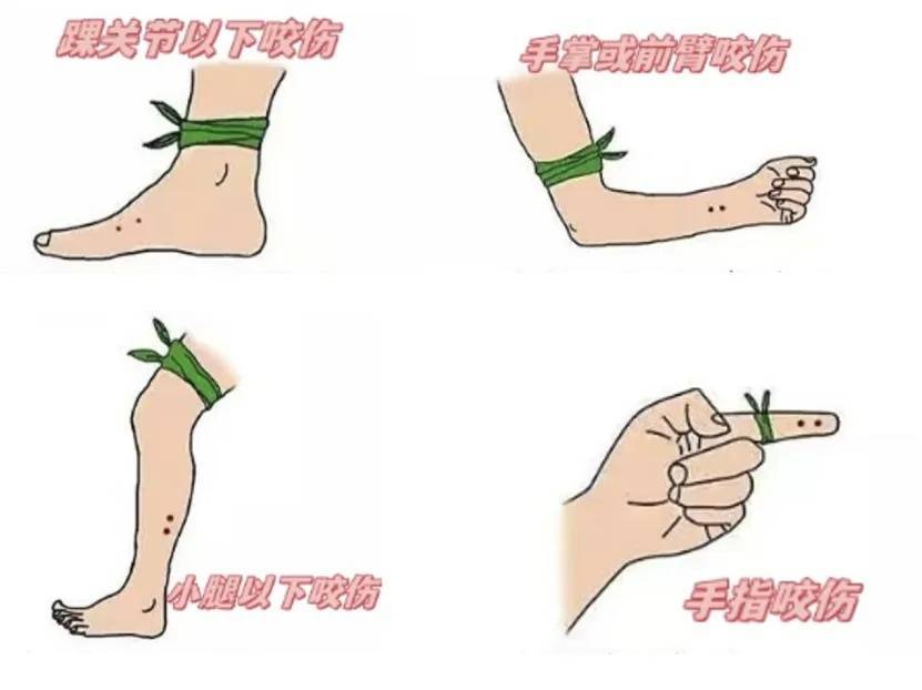 上海七旬老人小区散步被毒蛇咬伤,女儿崩溃:医院怎么选……这份救命指南快收好!