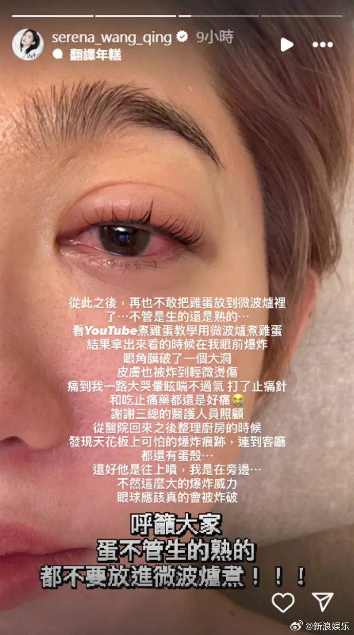 突然爆炸!知名女演员自曝:痛到大哭眩晕