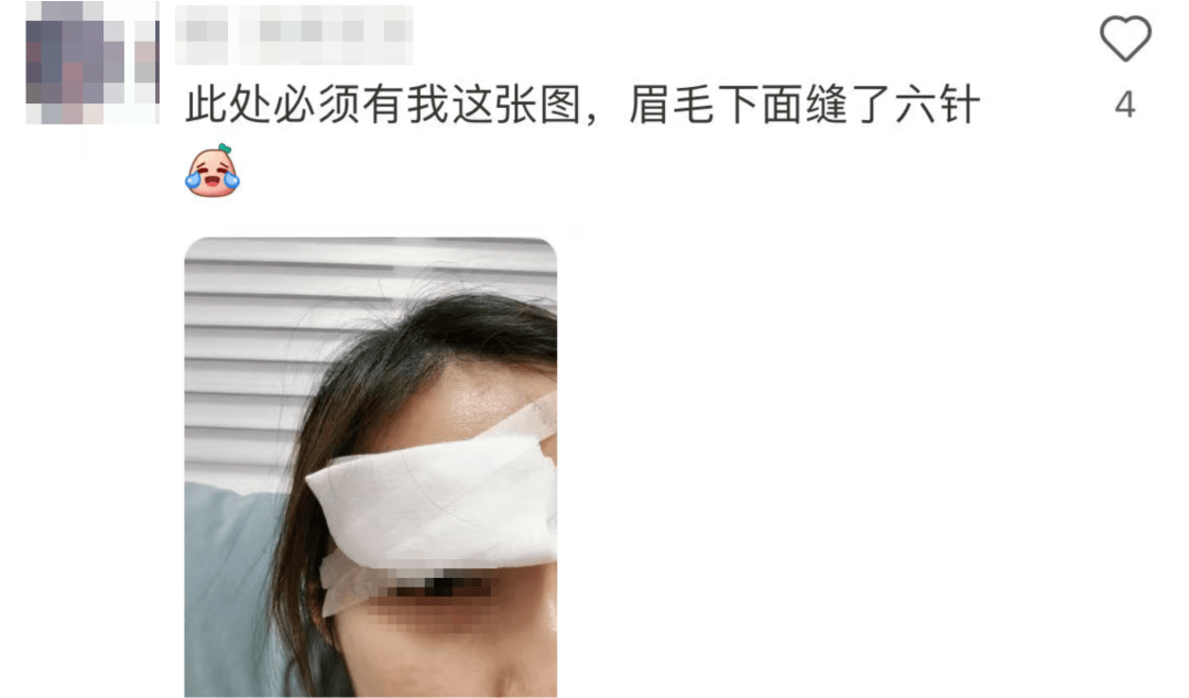 击穿眉骨、扎穿手指…这项人气运动暗藏风险!