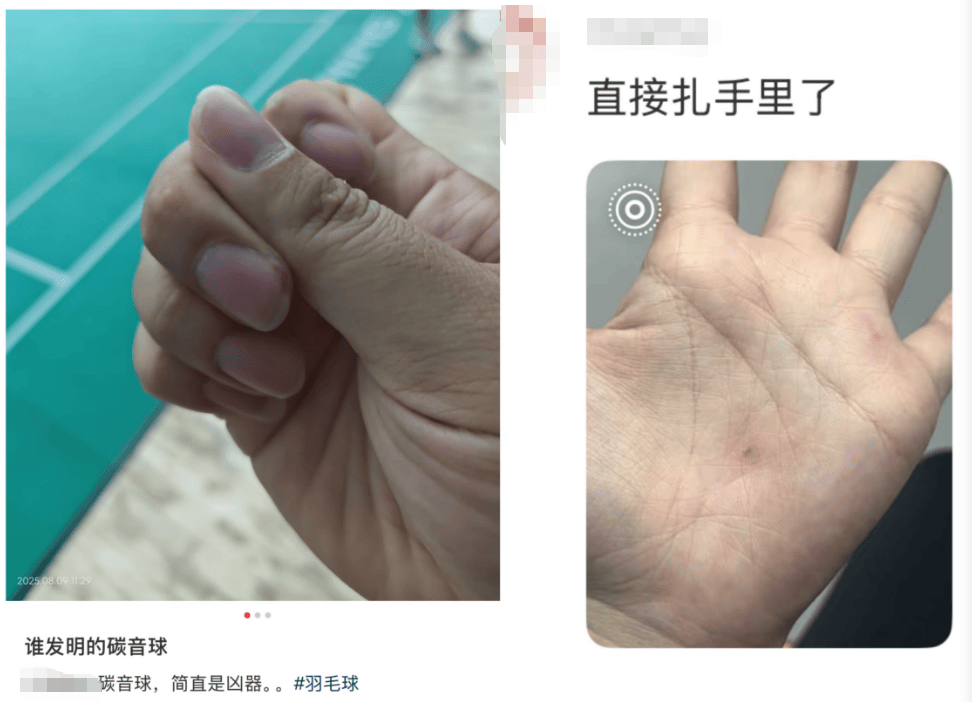 击穿眉骨、扎穿手指…这项人气运动暗藏风险!